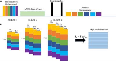 Super-Resolution Arterial Spin Labeling Using Slice-Dithered Enhanced Resolution and Simultaneous Multi-Slice Acquisition